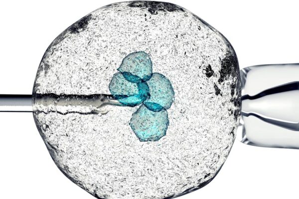 Trials demonstrate safety of stem cell therapy for Parkinson’s